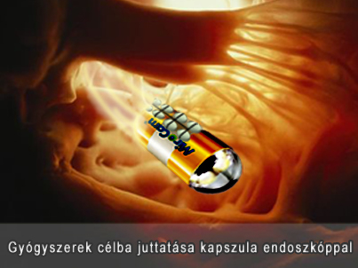 szállító kapszula